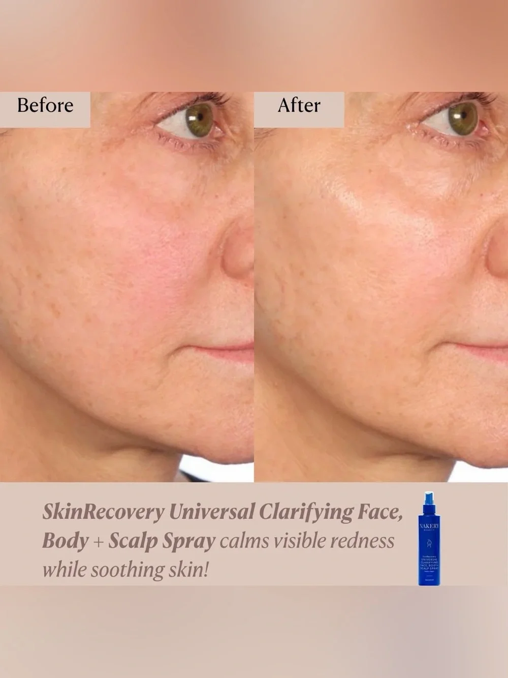 NAKERY BEAUTY SkinRecovery Universal Clarifying Face Body + Scalp Spray 8 oz